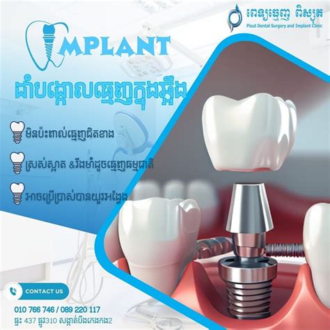 Dental Implants in Phnom Penh, Cambodia • Check .